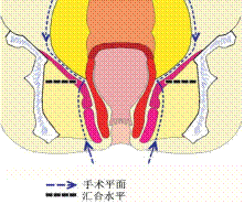 clip_image002.gif